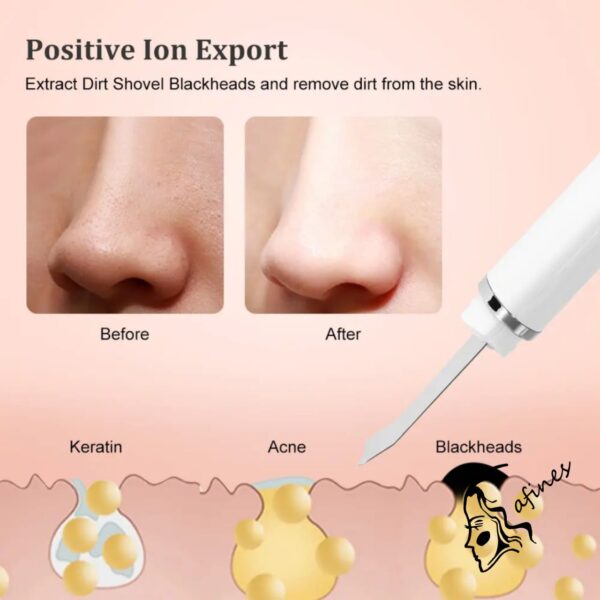 ESPATULA ULTRASONICA FACIAL AF51415 - Image 3